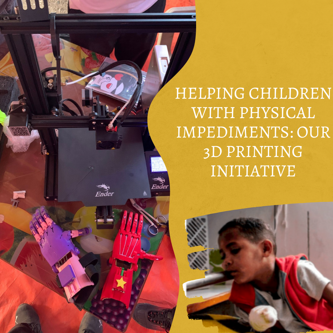 DEKNA’s Efforts to Provide Affordable Prosthetic Devices for Children Affected by the Tigray War